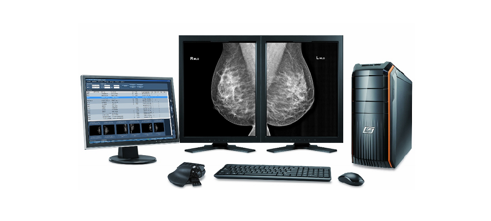 Digital Mammography Viewing Workstation